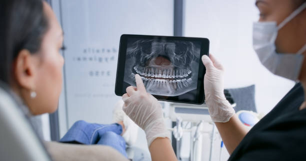 Licensed Dental Implants service in New Rockford, ND - Smile Center Dentistry